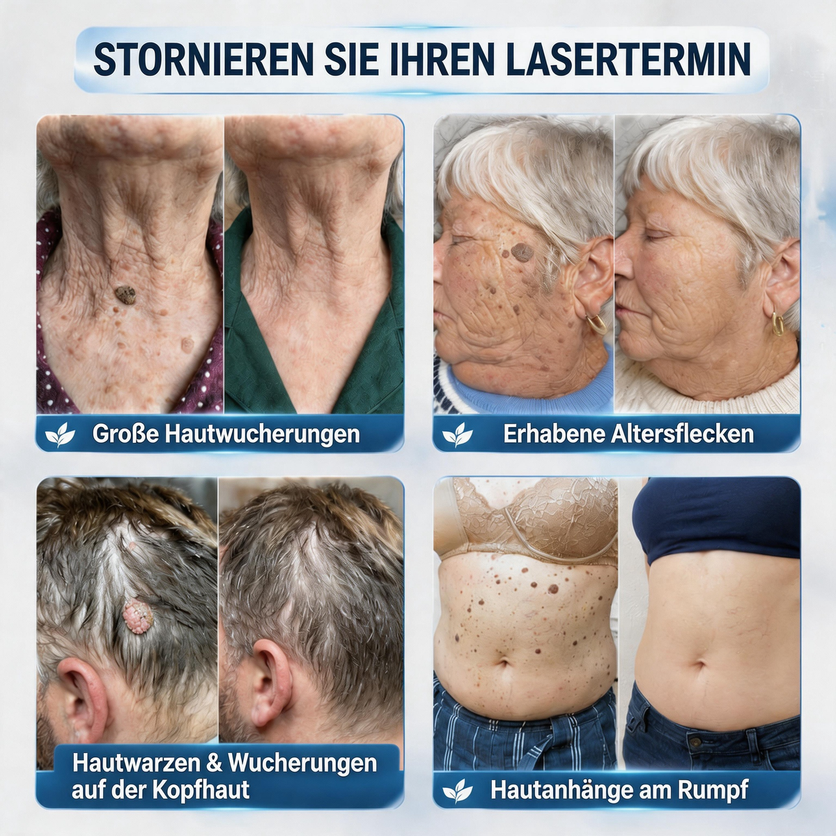Natravor® 7-Tage-Pflegecreme für Hautanhängsel & Hautflecken (𝐒𝐜𝐡𝐦𝐞𝐫𝐳𝐟𝐫𝐞𝐢𝐞 𝐅𝐨𝐫𝐦𝐞𝐥 – 𝐨𝐡𝐧𝐞 𝐍𝐚𝐫𝐛𝐞𝐧)